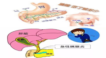 急性胰腺炎:是指多種病因導致胰酶在胰腺內被異常激活,對胰腺組織自身